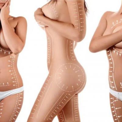 Body Contouring After Weight Loss surgery